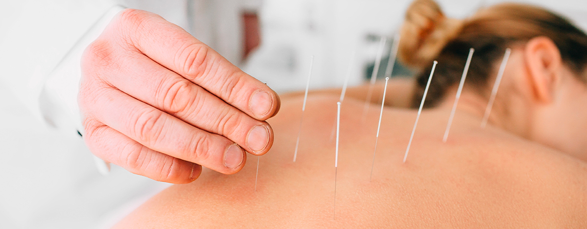 Acupunctura - uma prática terapêutica tradicional chinesa