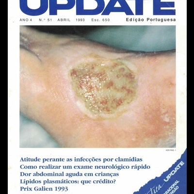 Update - Ano 4 - N.º 51 - Abril de 1993