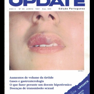 Update - Ano 3 - N.º 29 - Junho de 1991