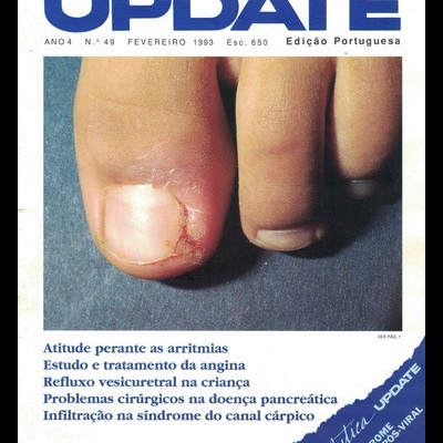 Update - Ano 4 - N.º 49 - Fevereiro de 1993