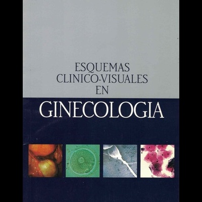 Esquemas Clinico-Visuales en Ginecologia | de Joaquín Borrull Sibina e Alfonso Vergés Torres