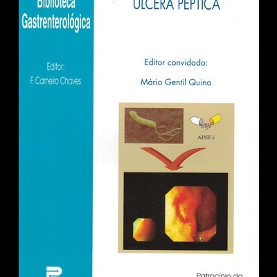 Úlcera Péptica | de Vários Autores
