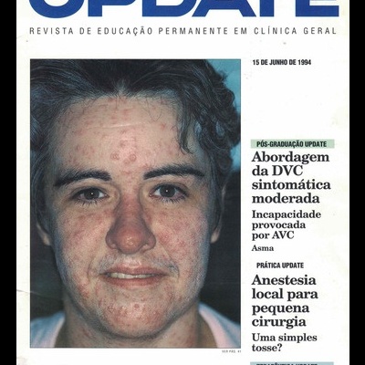 Update - Ano 6 - N.º 65 - 15 de Junho de 1994