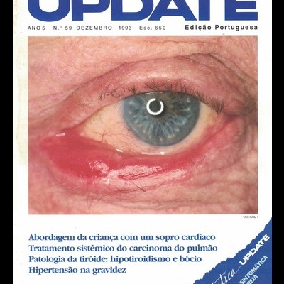 Update - Ano 5 - N.º 59 - Dezembro de 1993