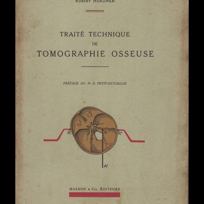 Traité Technique de Tomographie Osseuse | de Robert Herdner
