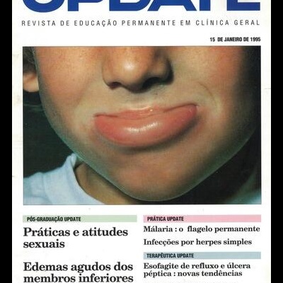 Update - Ano 6 - N.º 72 - 15 de Janeiro de  1995
