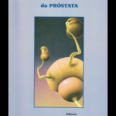 Hiperplasia Benigna da Próstata