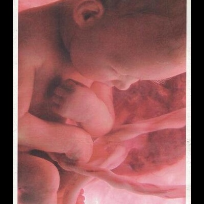 Vida no Ventre [DVD]