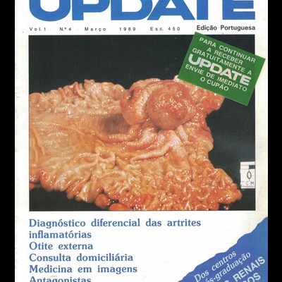 Update - Vol. 1 - N.º 4 - Março de 1989
