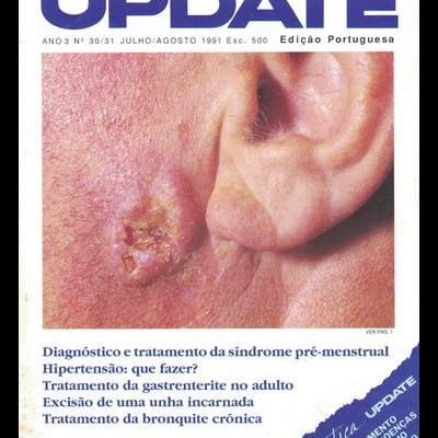 Update - Ano 3 - N.º 30/31 - Julho/Agosto 1991