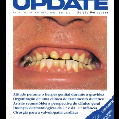 Update - Ano 4 - N.º 45 - Outubro 1992