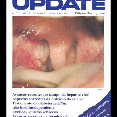 Update - Ano 3 - N.º 32 - Setembro de 1991
