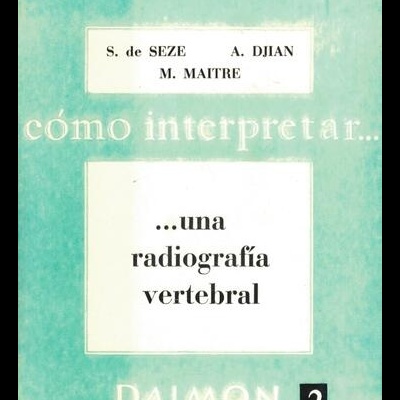 Cómo Interpretar una Radiografía Vertebral | de S. de Sèze, A. Djian e M. Maitre