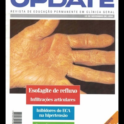 Update - Ano 8 - N.º 93 - 15 de Novembro de 1996