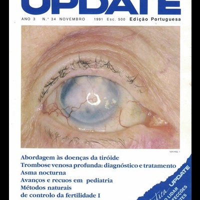 Update - Ano 3 - N.º 34 - Novembro de 1991