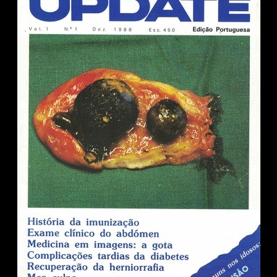 Update - Vol. 1 - N.º 1 - Dezembro 1988