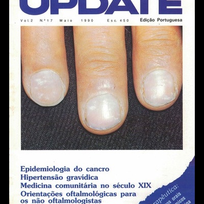 Update - Vol. 2 - N.º 17 - Maio 1990