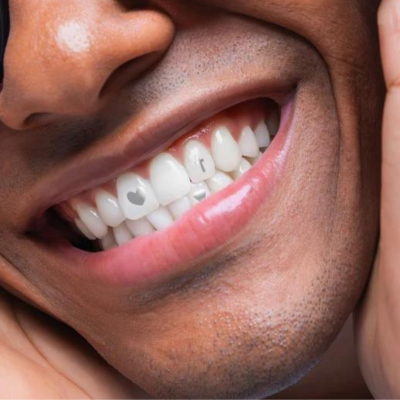 Hismile | SmileStika Mixed Gem Pack (adesivos metalizado para dentes)