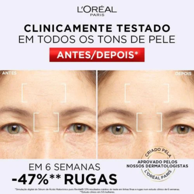 L'Oréal Paris | Sérum Anti-rugas Revitalift Filler 30ml
