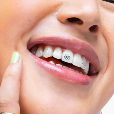 Hismile | SmileStika Flower Pack (Adesivos Flores para dentes)