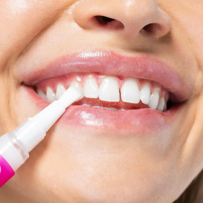 Hismile | PAP+ Caneta dentária corretora de cor 3ml