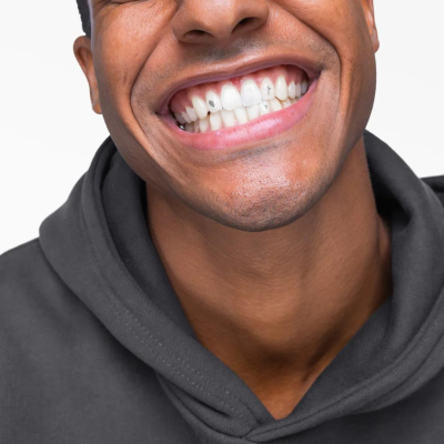 Hismile | SmileStika Mixed Gem Pack (adesivos metalizado para dentes)