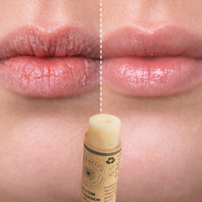 B&#x00E1;lsamo&#x20;Labial&#x20;Nutritivo&#x20;e&#x20;Reparador