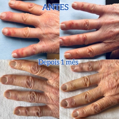 B&#x00E1;lsamo&#x20;Nutritivo,&#x20;Reparador&#x20;e&#x20;Cicatrizante