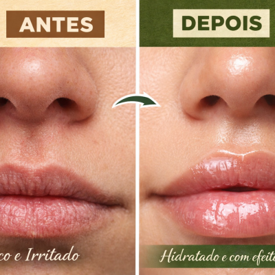 B&#x00E1;lsamo&#x20;Reparador&#x20;Nariz&#x20;e&#x20;l&#x00E1;bios