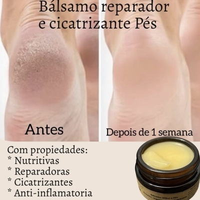 B&#x00E1;lsamo&#x20;Nutritivo,&#x20;Reparador&#x20;e&#x20;Cicatrizante