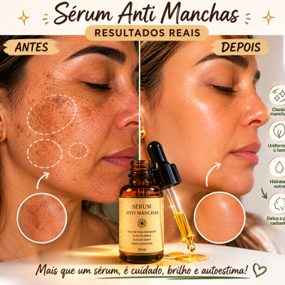 Serum&#x20;Anti-Manchas