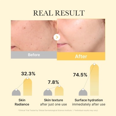 Medicube – Kojic Acid Turmenic Brightening Gel Mask, 4 máscaras