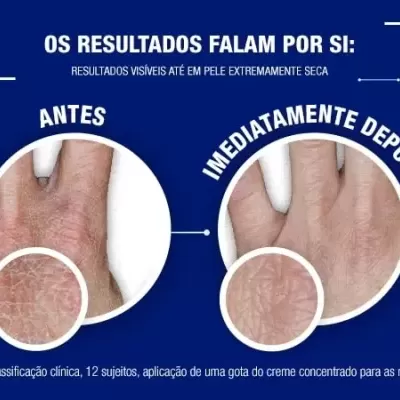 Neutrogena Creme de Mãos Concentrado sem Perfume 50ml