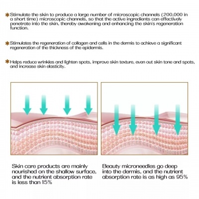 Derma Roller DRS - 540 / 1200 agulhas  |   0.5 - 1.0 mm (for hair regrowth / skin) Derma Roller DRS - 540 / 1200 agulhas  |   0.5 - 1.0 mm (for hair regrowth / skin)