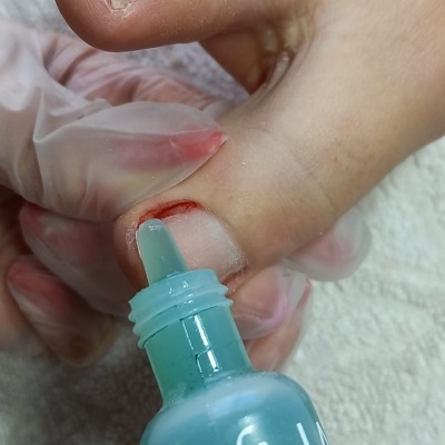 Essência Hemostática 15ml para Manicure ? Estanca Sangue e Desinfeta em Segundos