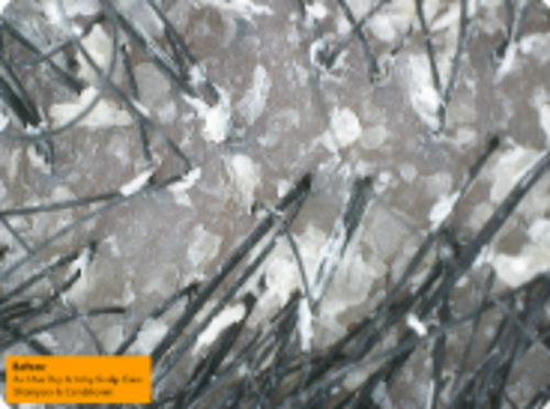 Condicionador As I Am Dry & Itchy Scalp Care Dandruff