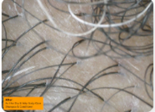 Condicionador As I Am Dry & Itchy Scalp Care Dandruff